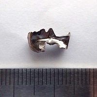 歯の詰め物：表面